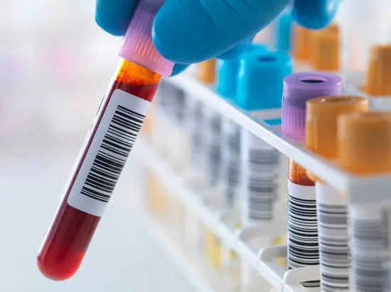 Image shows blood samples in test tubes.